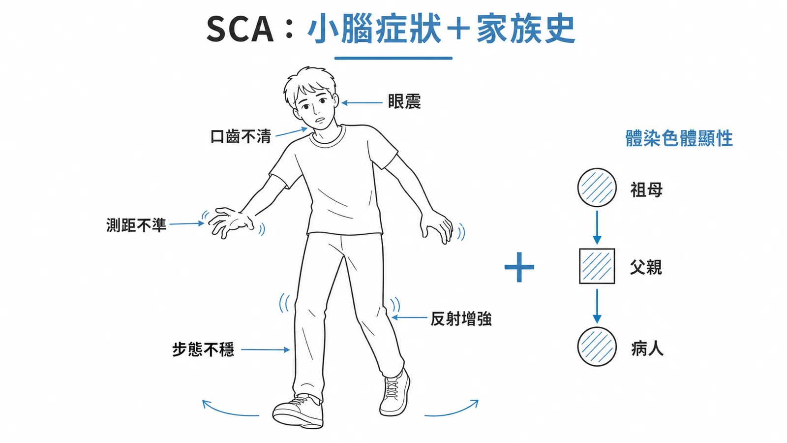 SCA診斷特徵:小腦症狀(眼震、口齒不清、測距不準、步態不穩)加體染色體顯性家族史