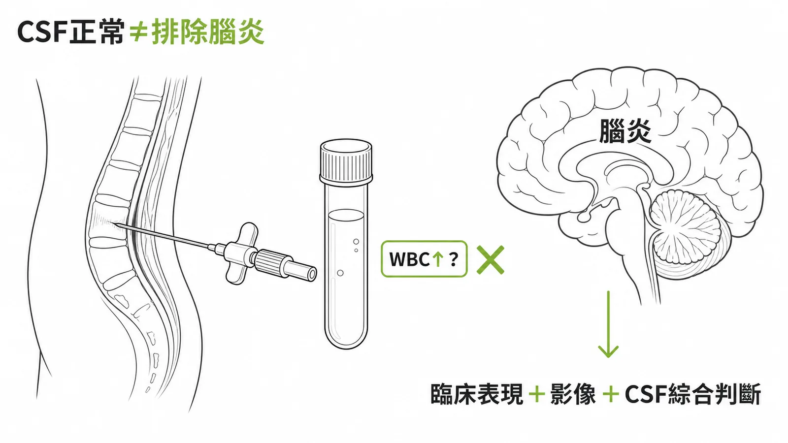 CSF正常不等於排除腦炎:白血球增加非診斷必要條件,需臨床表現、影像與CSF綜合判斷