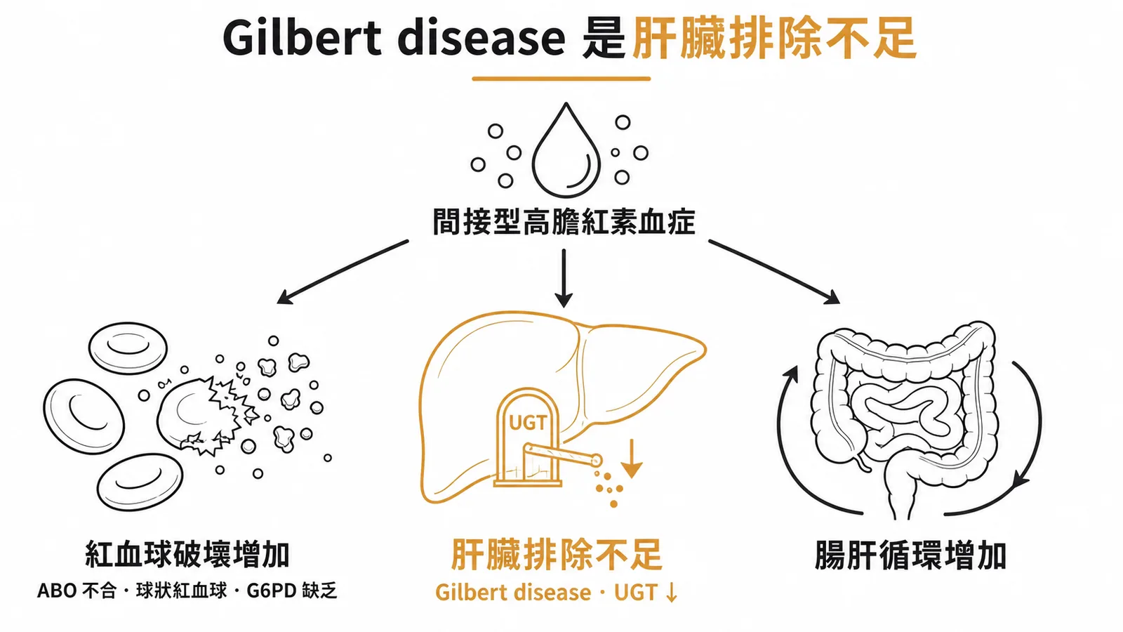 新生兒間接型高膽紅素血症三大成因分類示意圖