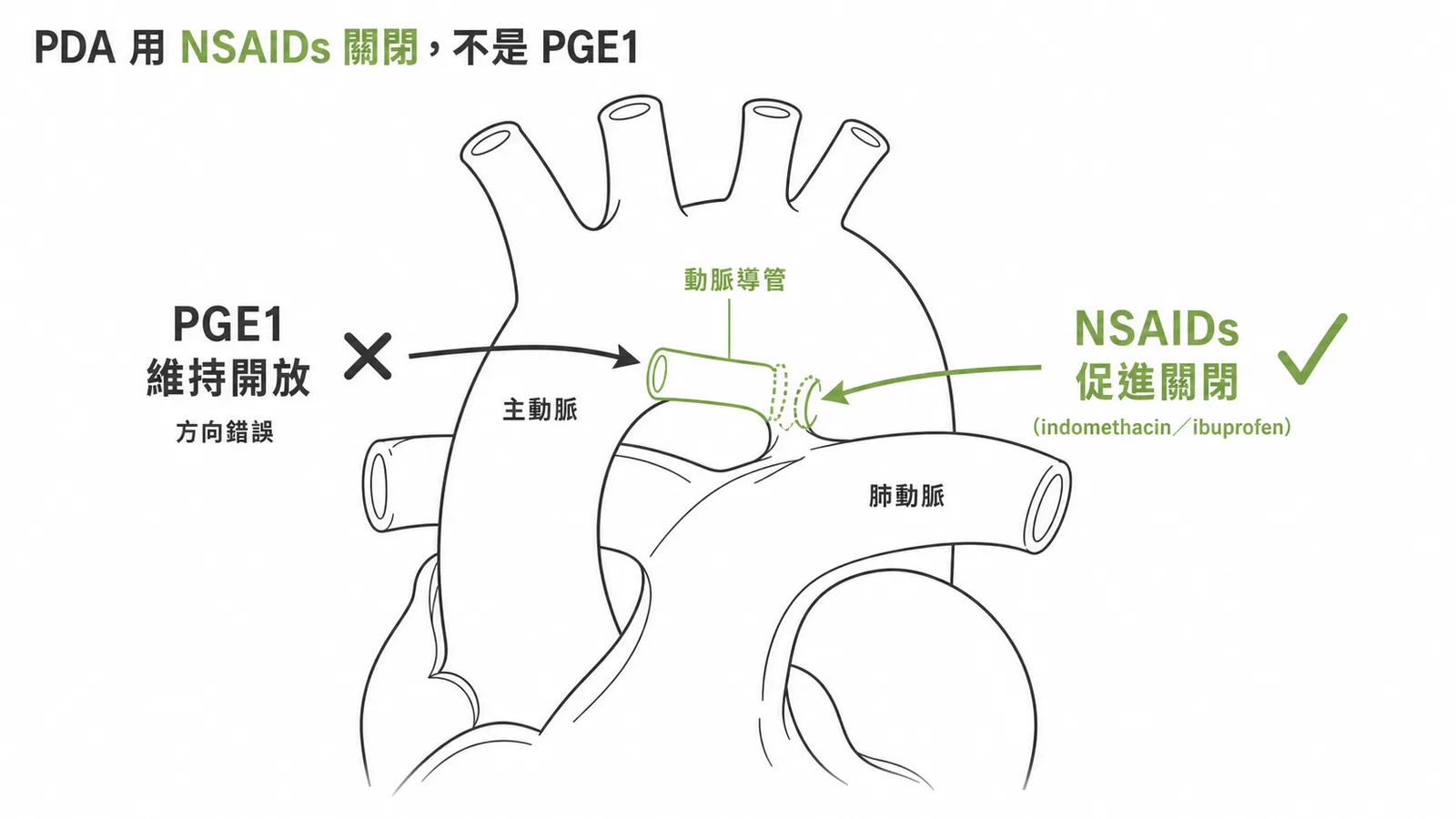 PDA藥物治療方向對照圖