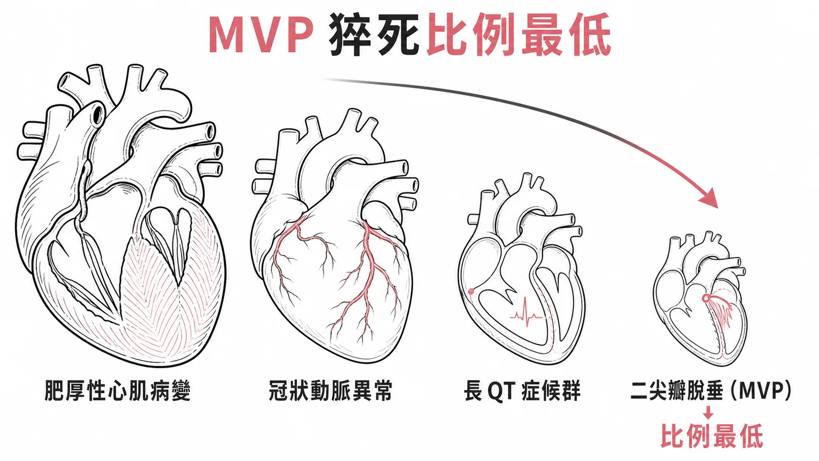 兒童猝死原因比例對照圖