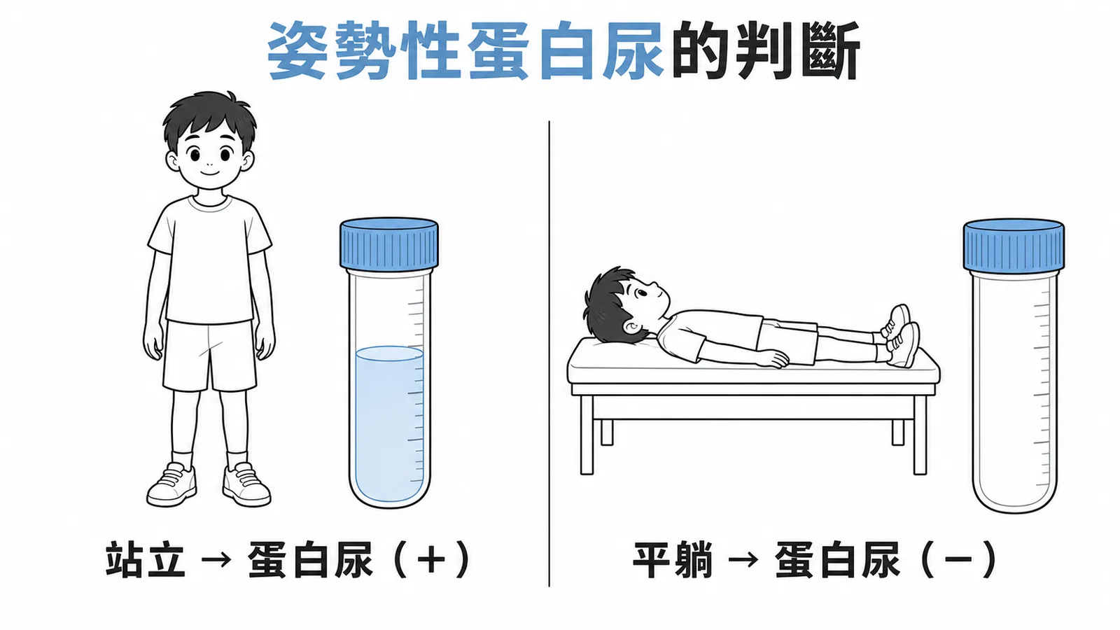 姿勢性蛋白尿：站立時陽性、平躺時消失
