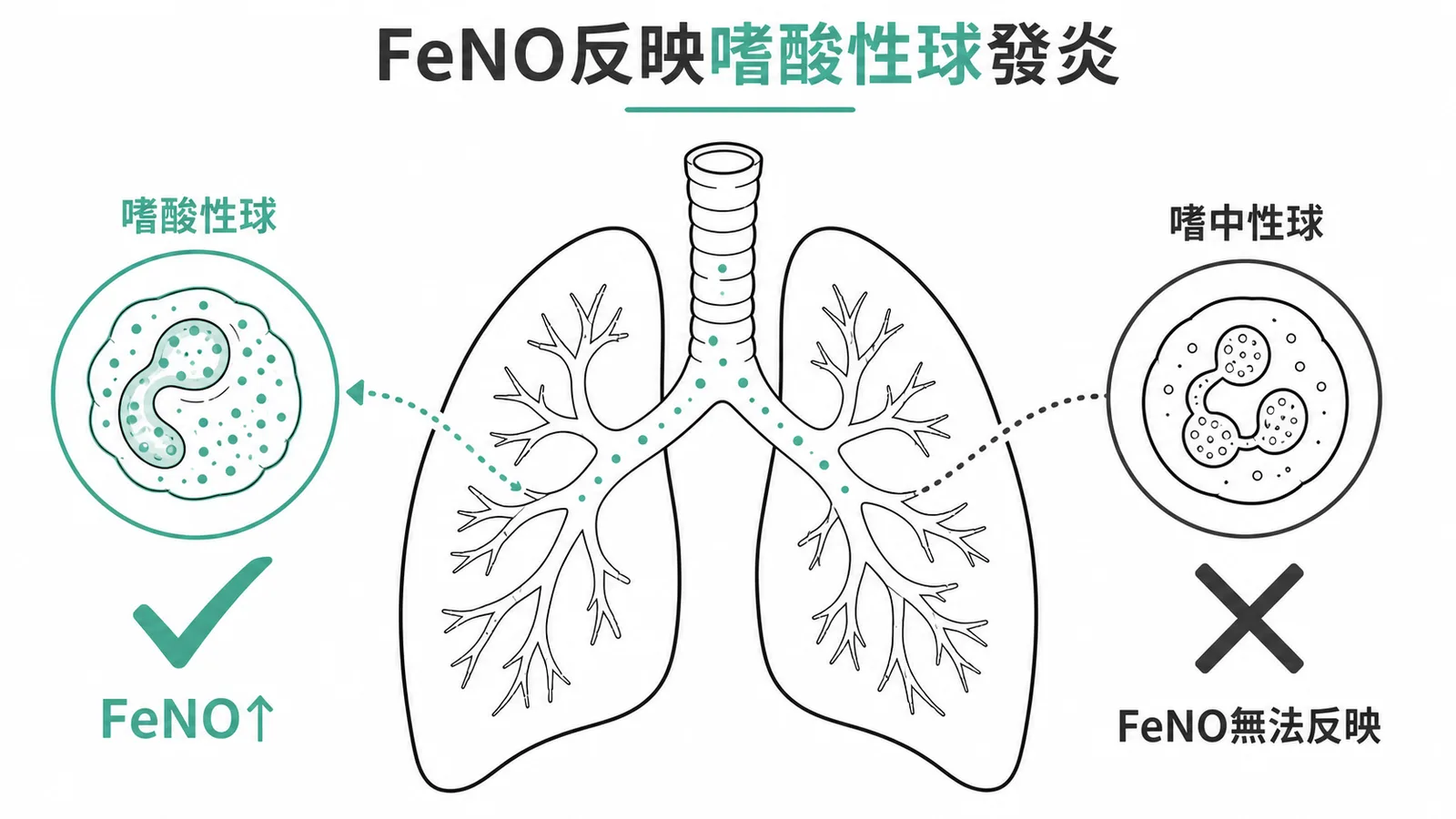 FeNO反映嗜酸性球氣道發炎，無法反映嗜中性球