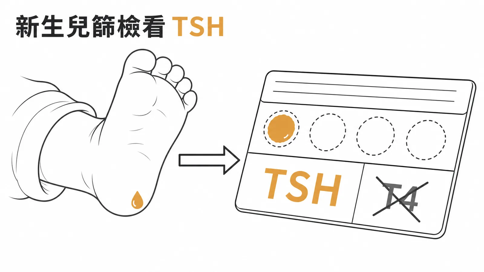 新生兒篩檢先天性甲狀腺低能症主要檢驗TSH而非T4