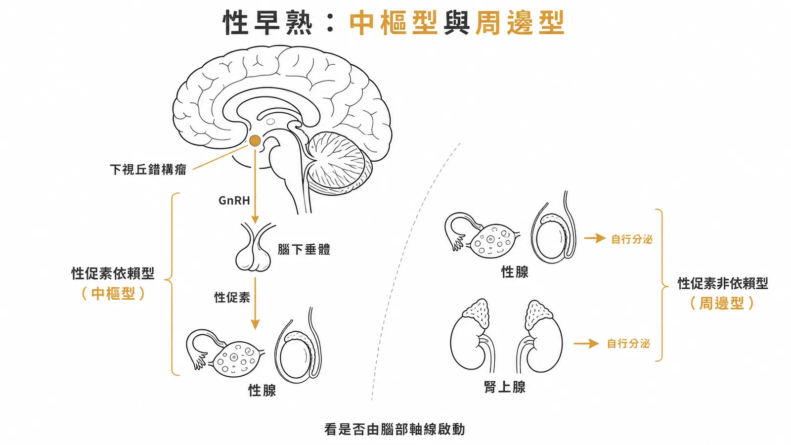 性早熟分中樞型(性促素依賴)與周邊型(性促素非依賴)兩大類
