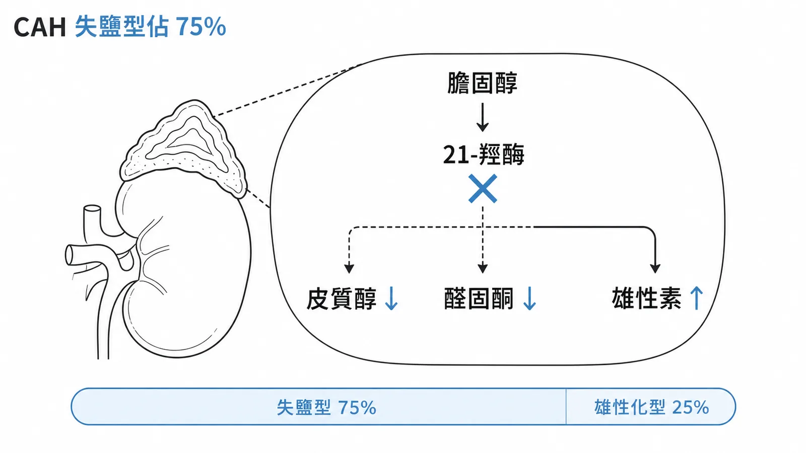 21-羥酶缺乏CAH中失鹽型佔75%為最常見類型