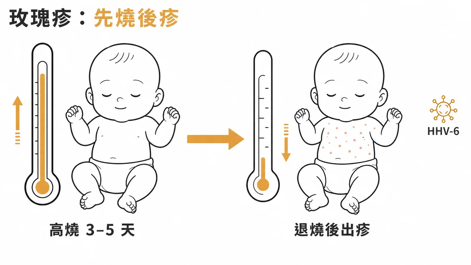 嬰兒玫瑰疹HHV-6典型表現為先高燒3至5天退燒後才出疹