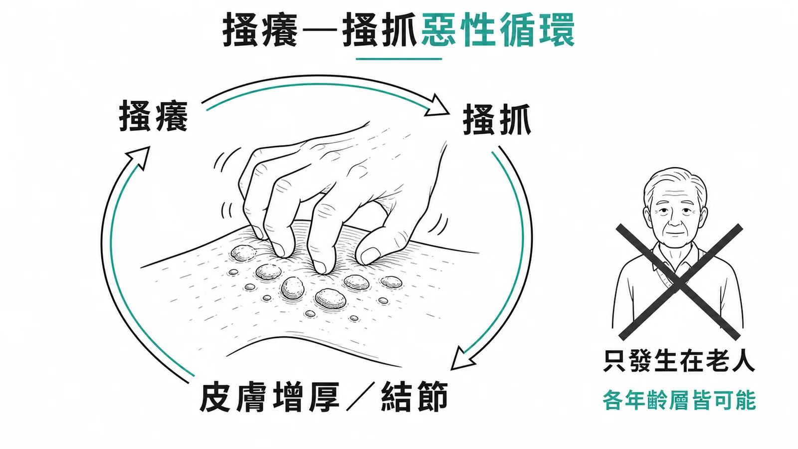 搔癢搔抓惡性循環與各年齡層皆可發生的示意圖
