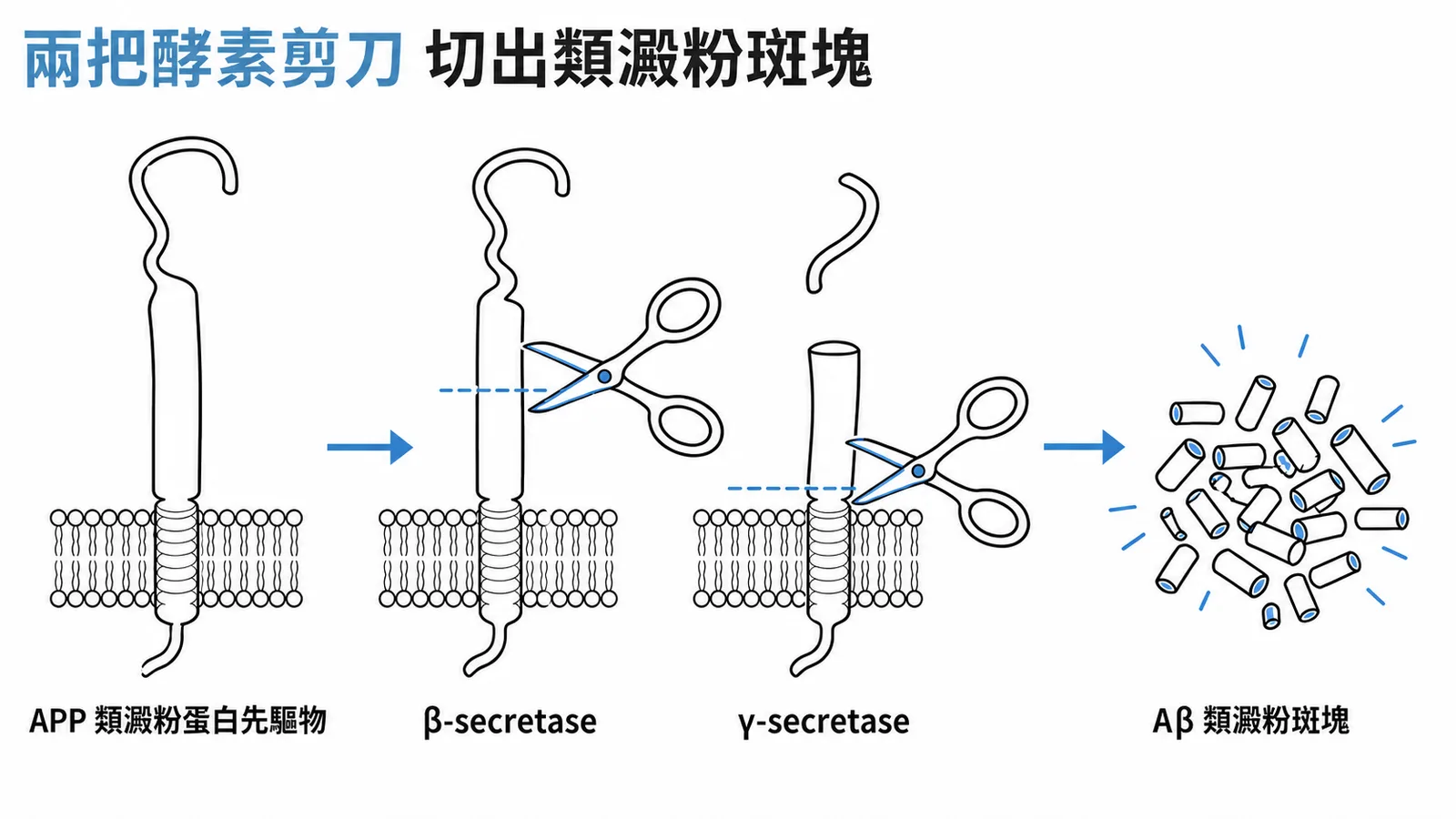 阿茲海默氏病：APP 經 β-secretase 與 γ-secretase 兩種酵素依序裁切形成 Aβ 類澱粉斑塊