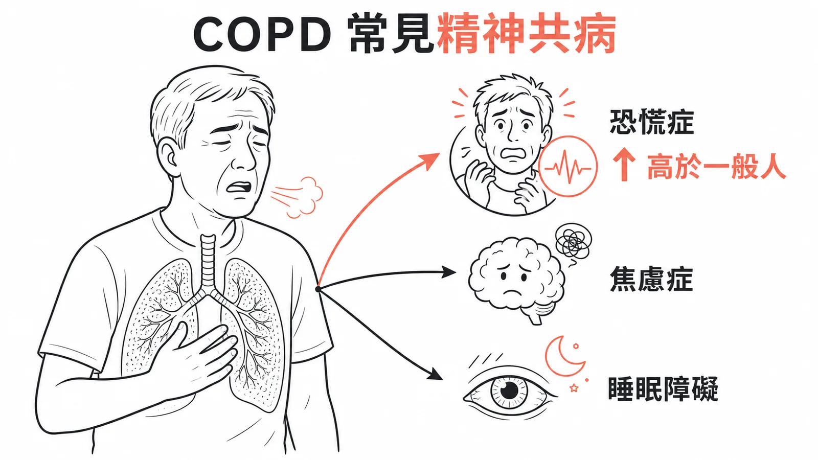 COPD 常見精神共病:恐慌症、焦慮症、睡眠障礙