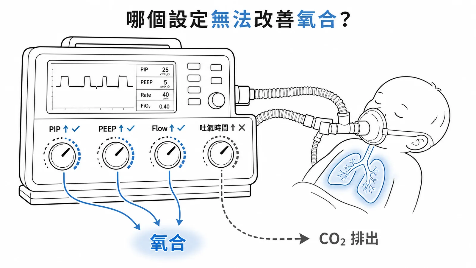 呼吸器設定:增加吐氣時間無法改善氧合