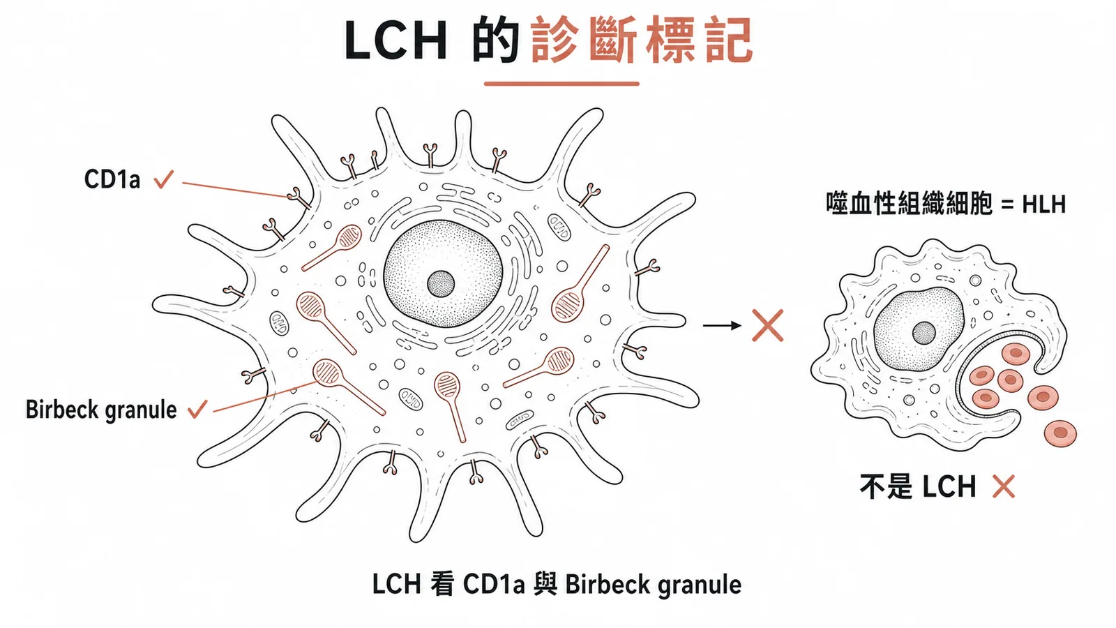 LCH 的特徵是 CD1a 和 Birbeck granule,非噬血性組織細胞