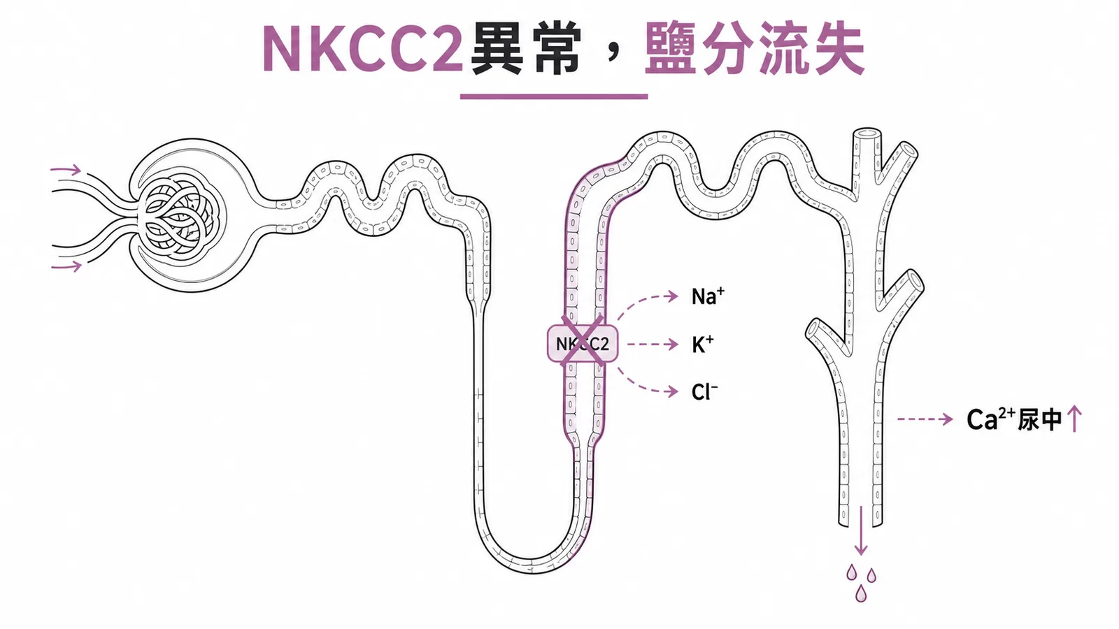 巴特氏症候群腎小管離子流失機轉示意圖