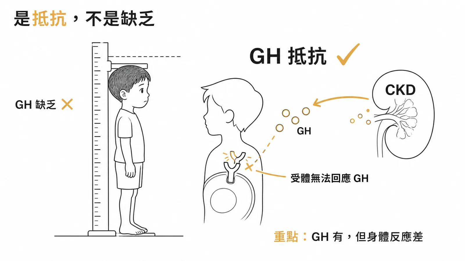 兒童慢性腎臟病身材矮小為生長激素抵抗而非缺乏示意圖