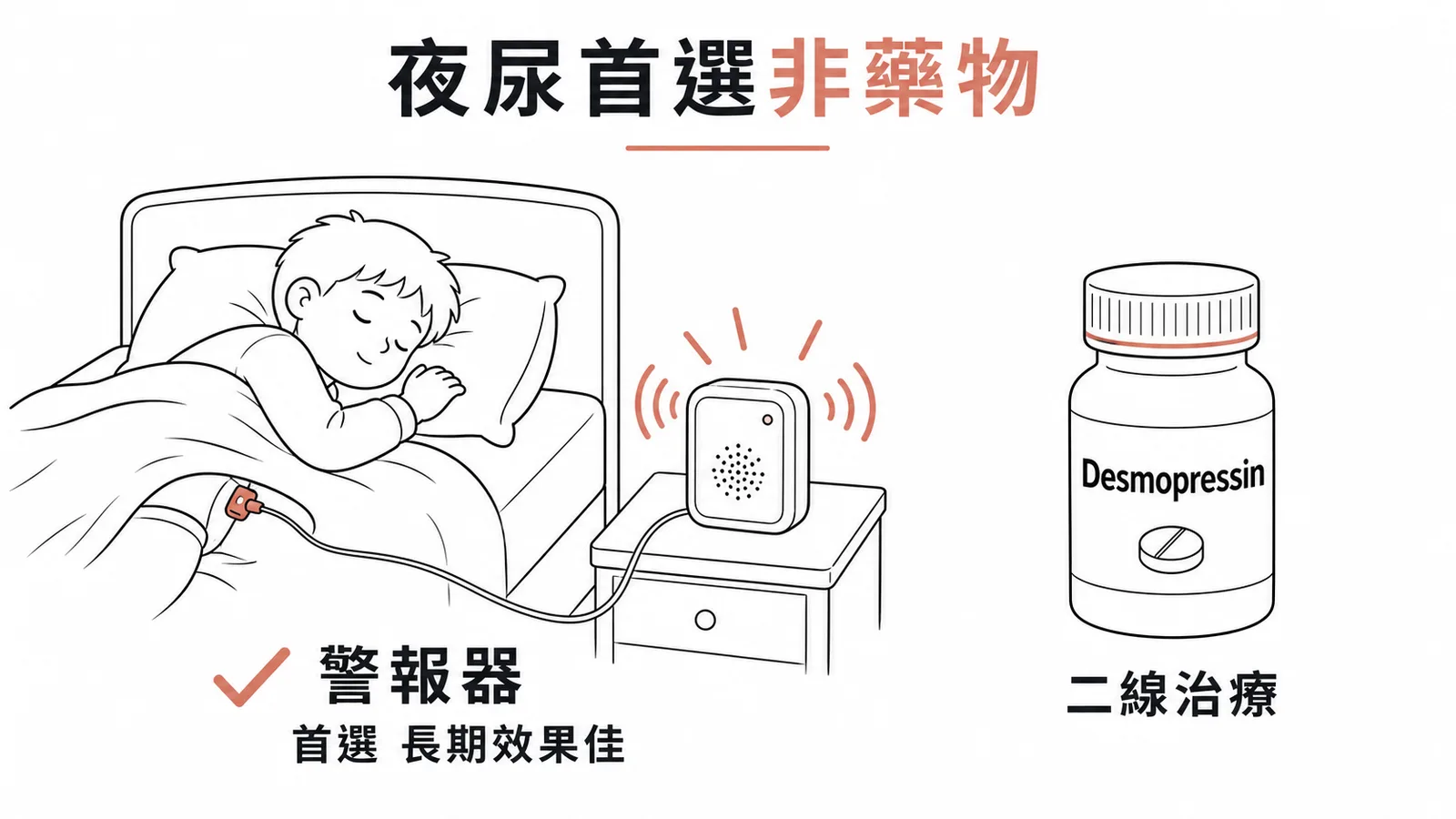 夜尿首選治療為夜尿警報器非 Desmopressin 示意圖