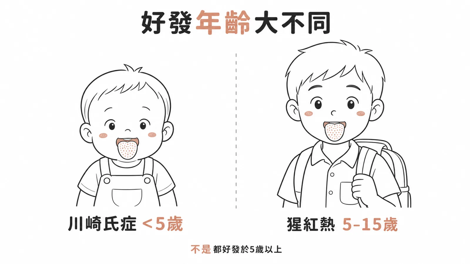 猩紅熱好發學齡兒童與川崎氏症好發五歲以下對照圖