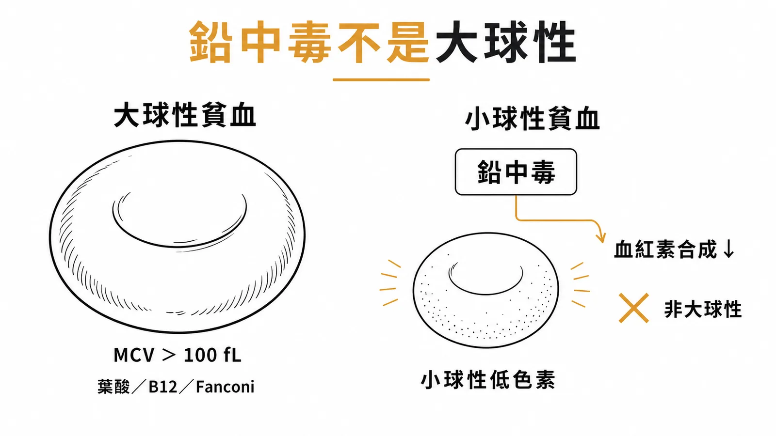 大球性貧血與小球性貧血的鑑別:鉛中毒屬小球性