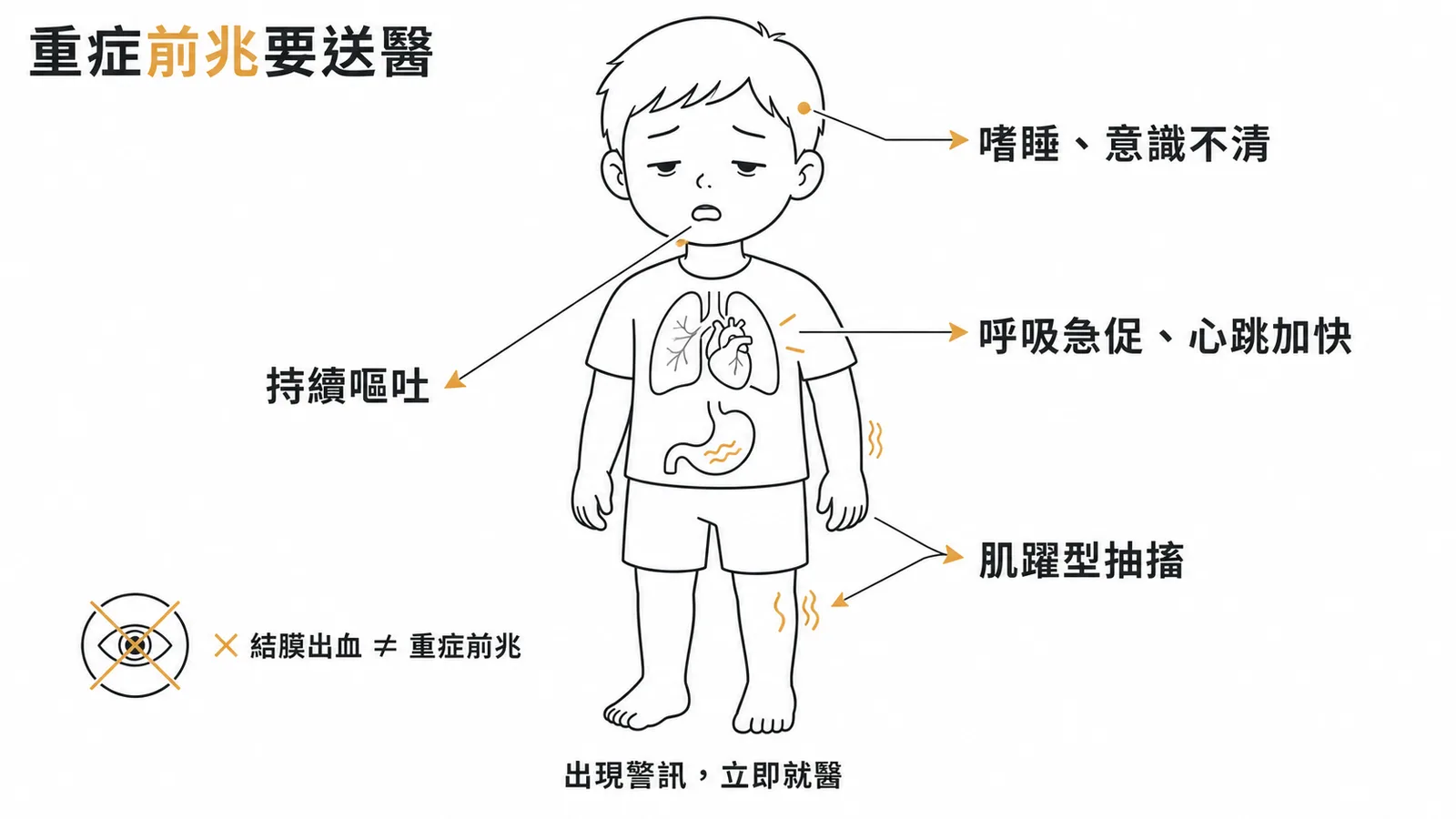 腸病毒重症前兆:嗜睡、持續嘔吐、肌躍型抽搐、呼吸急促