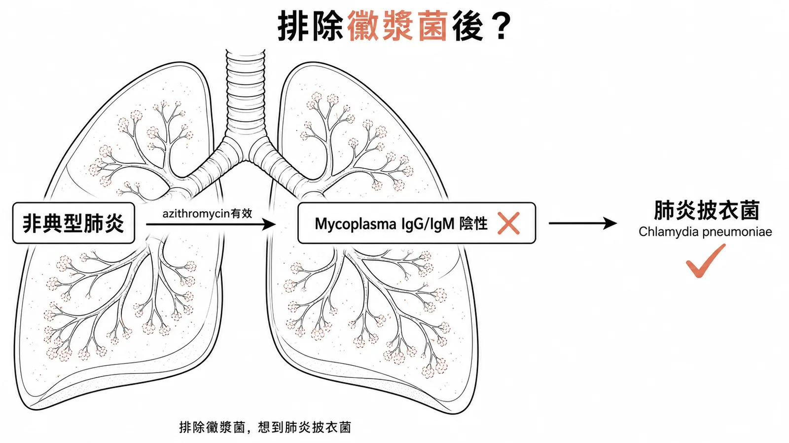 非典型肺炎排除Mycoplasma後最可能是肺炎披衣菌