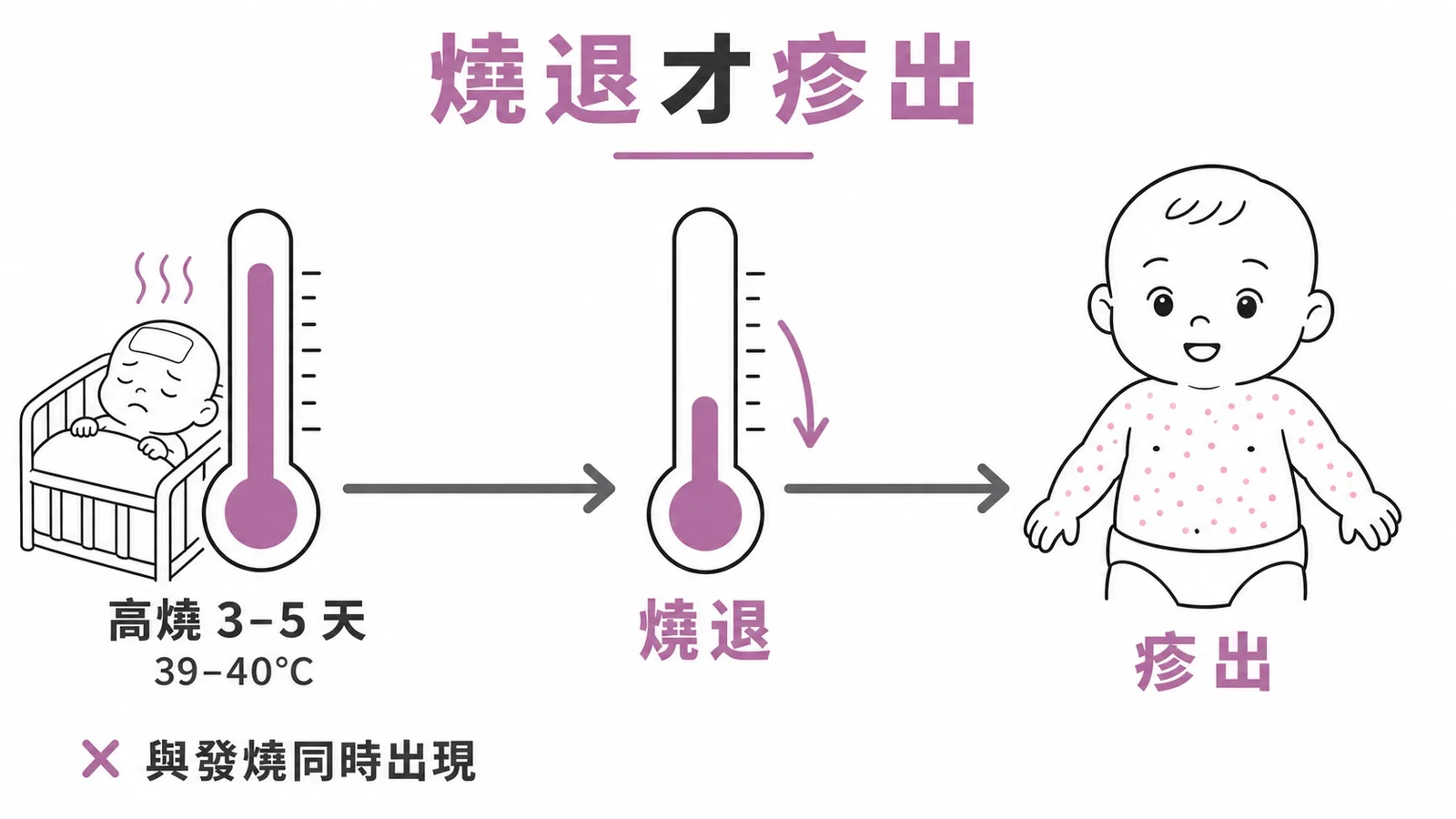 嬰兒玫瑰疹典型特徵是燒退疹出而非同時出現