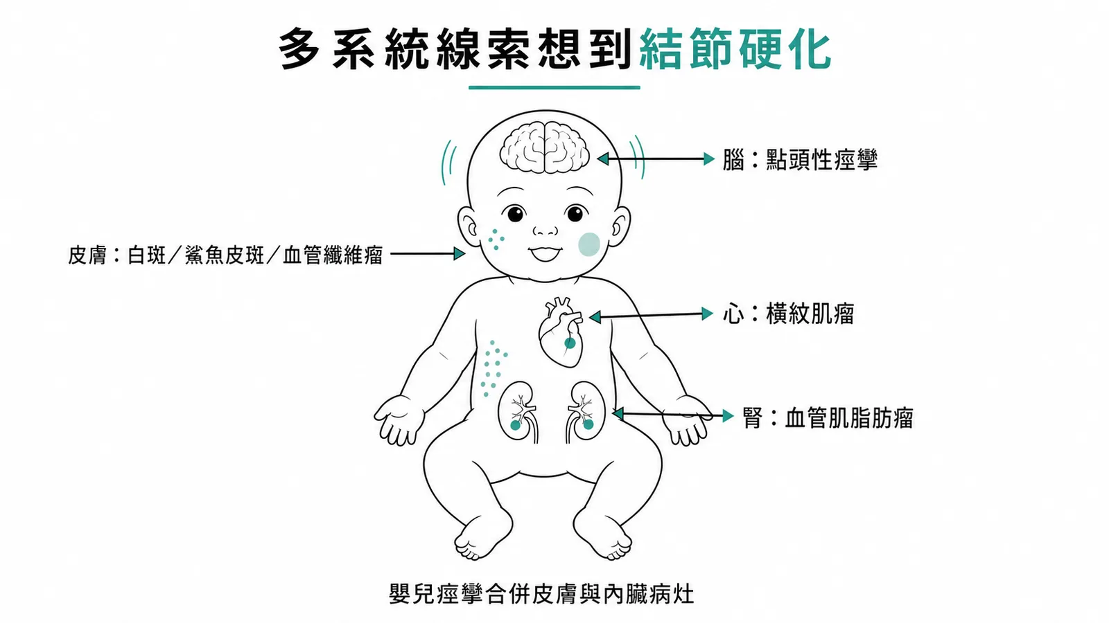結節性硬化症多系統表現示意圖