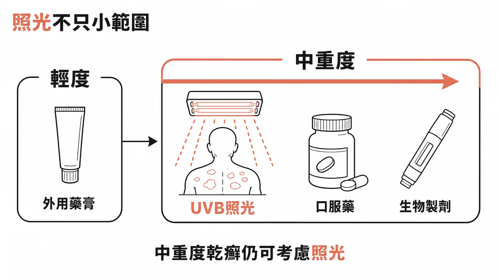 乾癬治療階梯:照光適用中重度