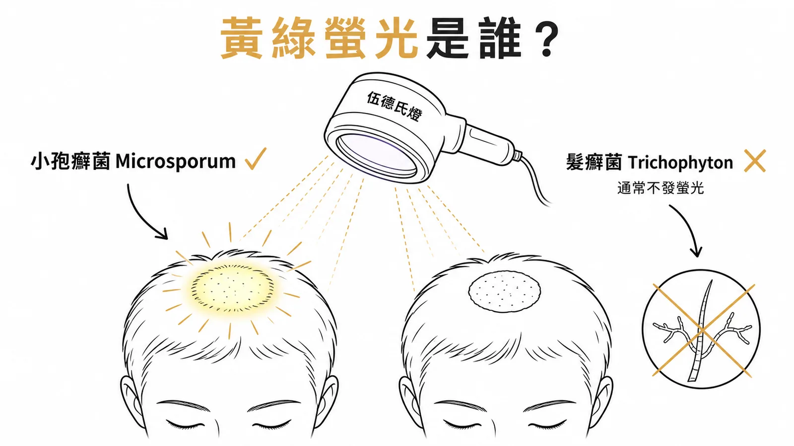伍氏燈黃綠色螢光指向小孢癬菌非髮癬菌