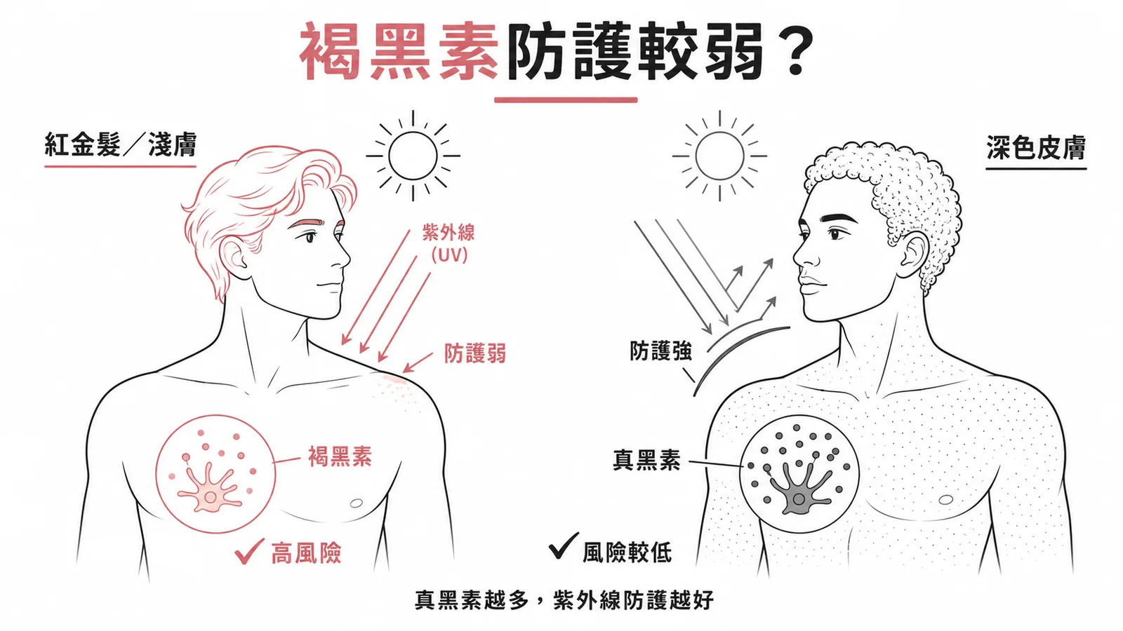 紅髮金髮者黑色素細胞癌風險較高的示意圖