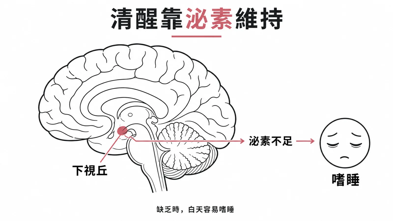 嗜睡症致病機轉:下視丘泌素缺乏導致四聯症