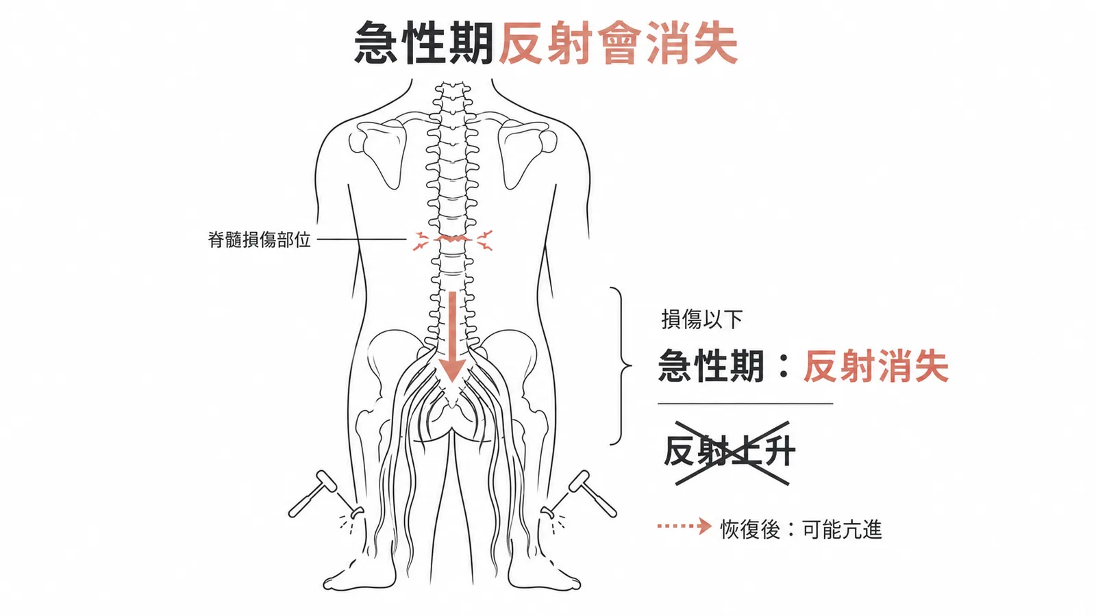 脊椎性休克初期反射消失而非上升