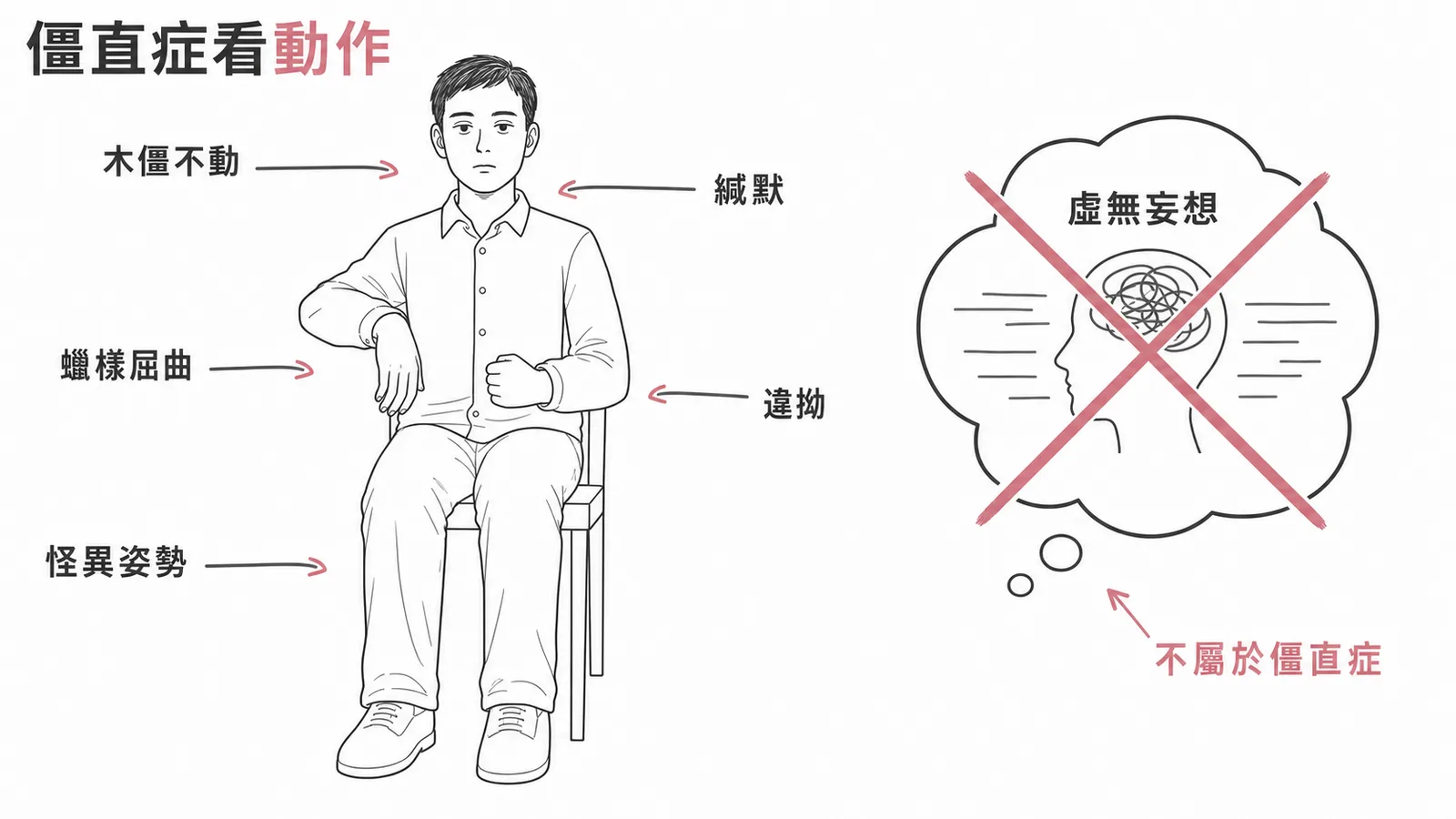 僵直症核心為精神運動障礙,虛無妄想不屬此類