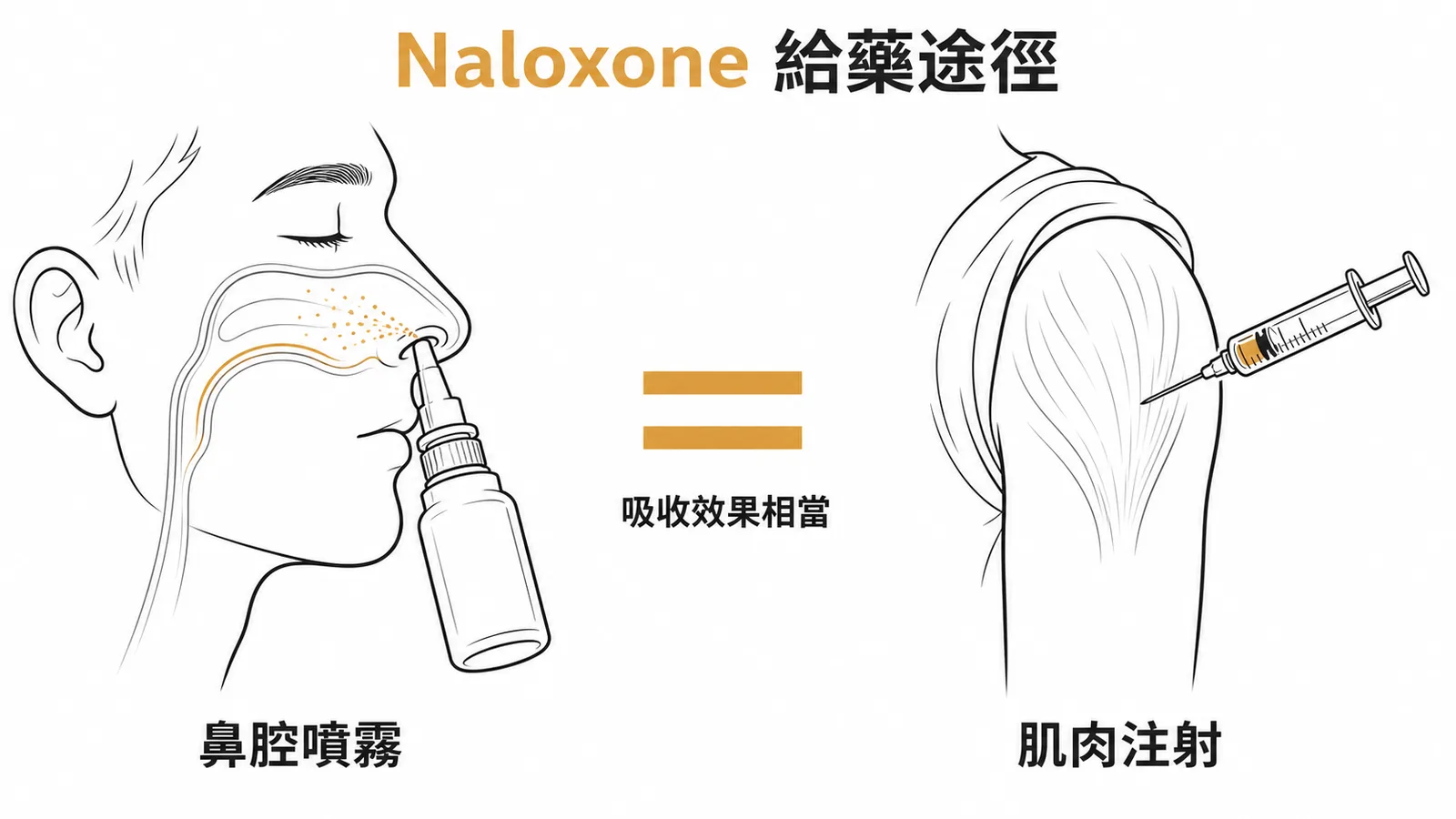 納洛酮鼻腔噴霧吸收效果等同肌肉注射