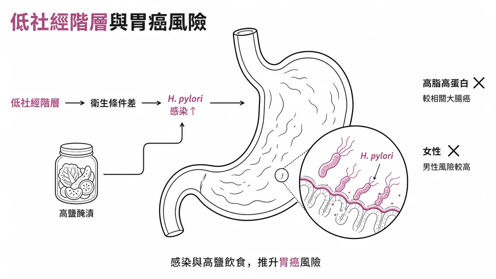 低社經階層與胃癌風險：衛生差致 H. pylori 感染及高鹽醃漬飲食