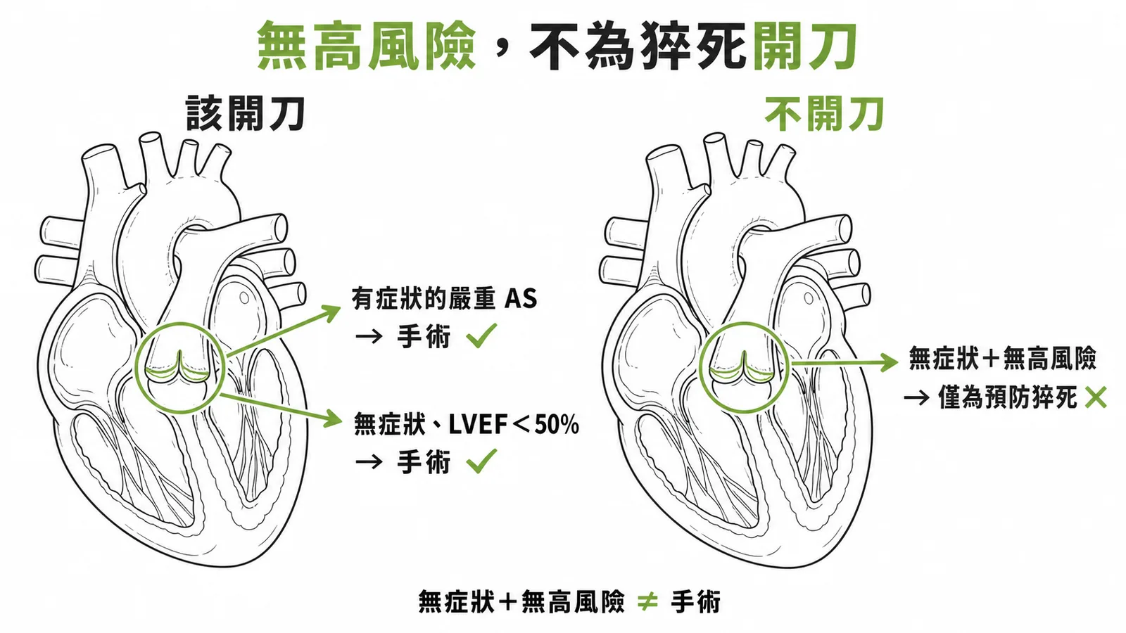 無症狀嚴重主動脈瓣狹窄無高風險因子不應僅為預防猝死開刀