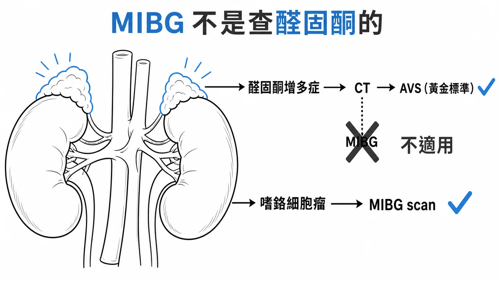 MIBG 是查嗜鉻細胞瘤的，醛固酮增多症定位用 CT 加 AVS