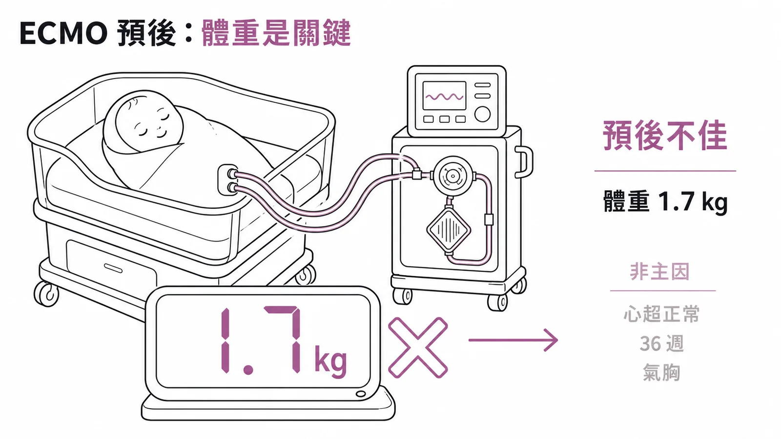 CDH 嬰兒使用 ECMO 時體重 1.7 kg 是預後不佳的最強指標