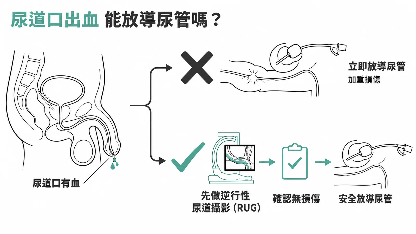 尿道口出血處置流程：禁止立即放導尿管，應先做逆行性尿道攝影確認無損傷後才安全放置