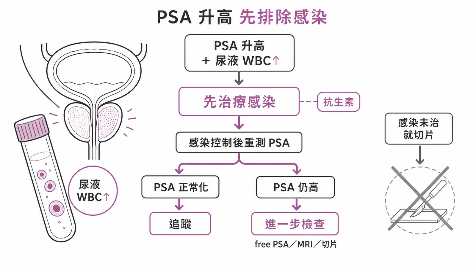 PSA升高合併感染時先治療感染再重測的流程示意圖