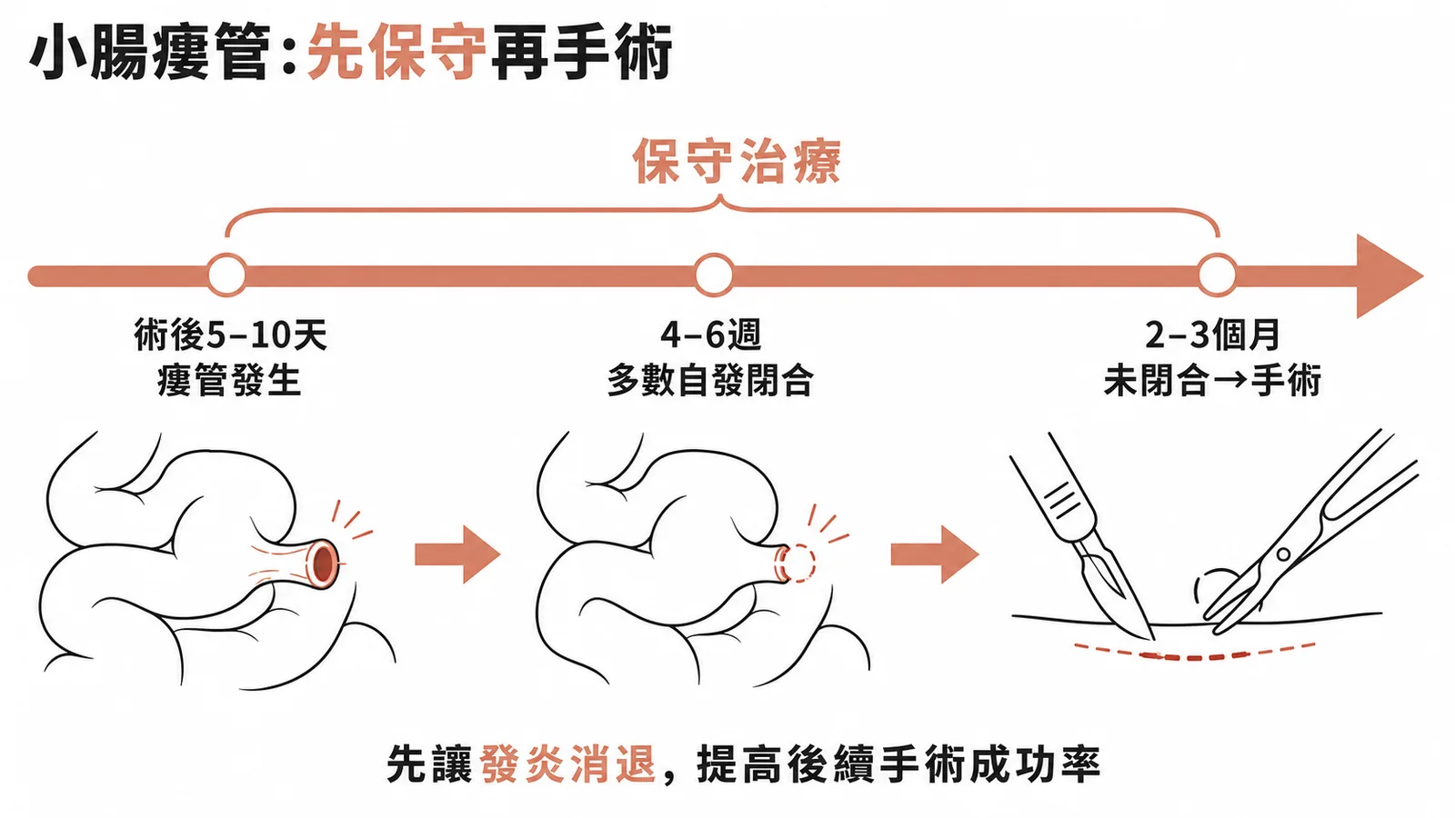 小腸瘻管治療時間軸先保守治療再考慮手術