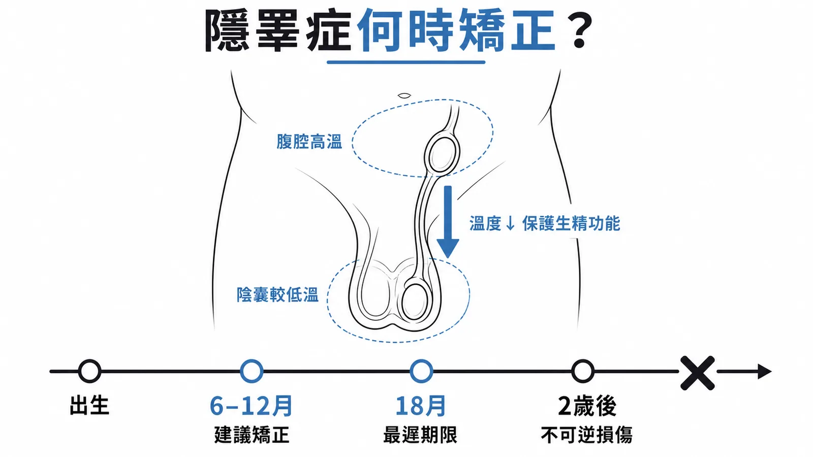 隱睪症建議 6-12 月矯正，最遲 18 月，2 歲後生精功能不可逆損傷