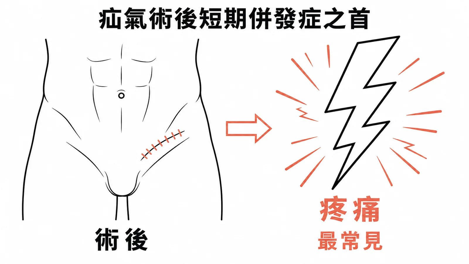 疝氣術後短期併發症之首——疼痛是最常見的術後短期反應