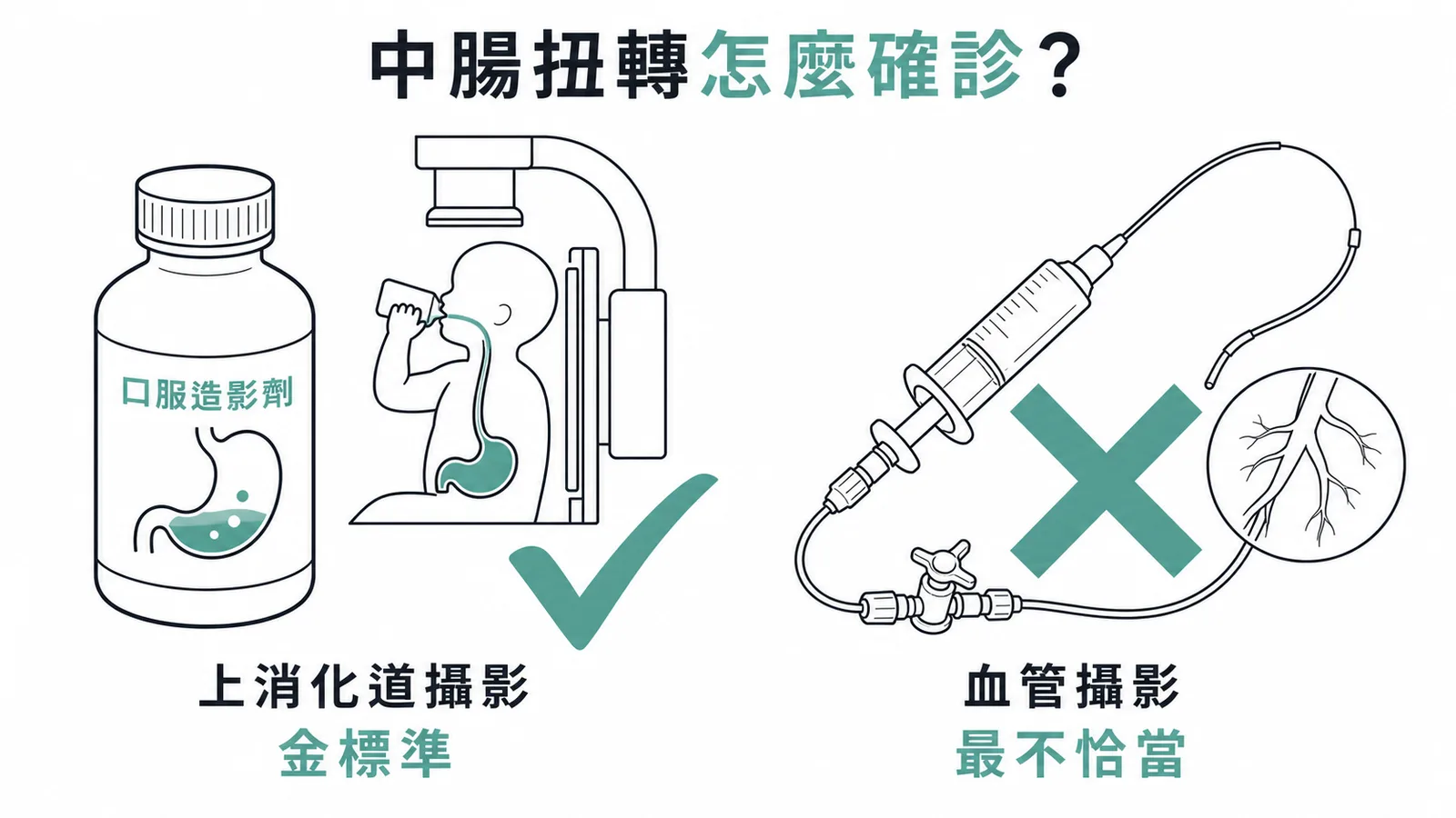 中腸扭轉確診方法對比——上消化道攝影為金標準而血管攝影最不恰當