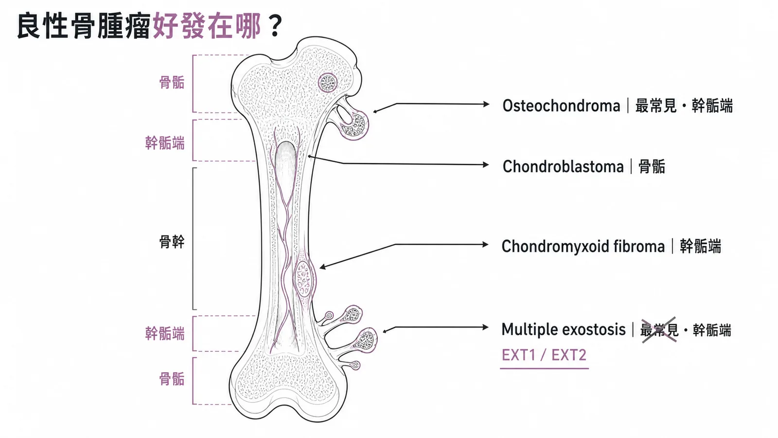 良性骨腫瘤好發位置分類比較