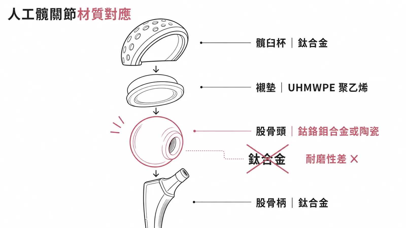 人工髖關節各組件材質對應