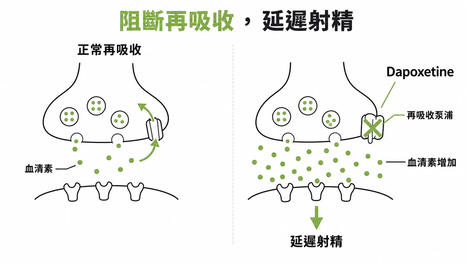 Dapoxetine阻斷血清素再吸收延遲射精機轉示意圖
