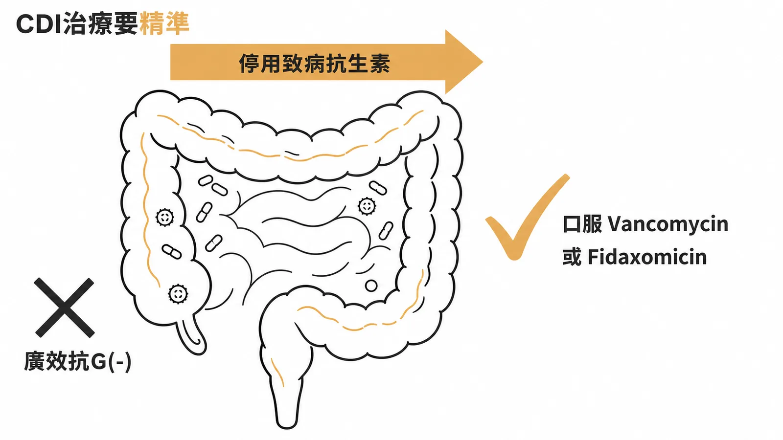 CDI治療停用致病抗生素改用口服Vancomycin或Fidaxomicin