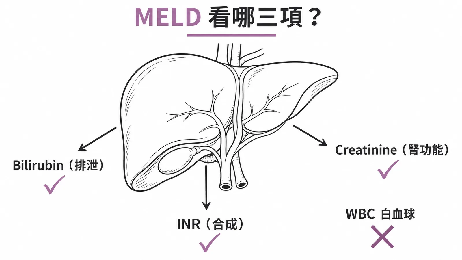 MELD score三大參數Bilirubin加Creatinine加INR而非WBC