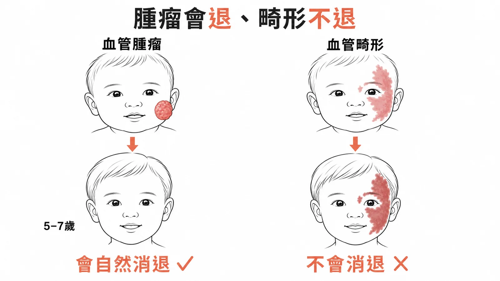 血管腫瘤會自然消退vs血管畸形不會消退且隨年齡加深