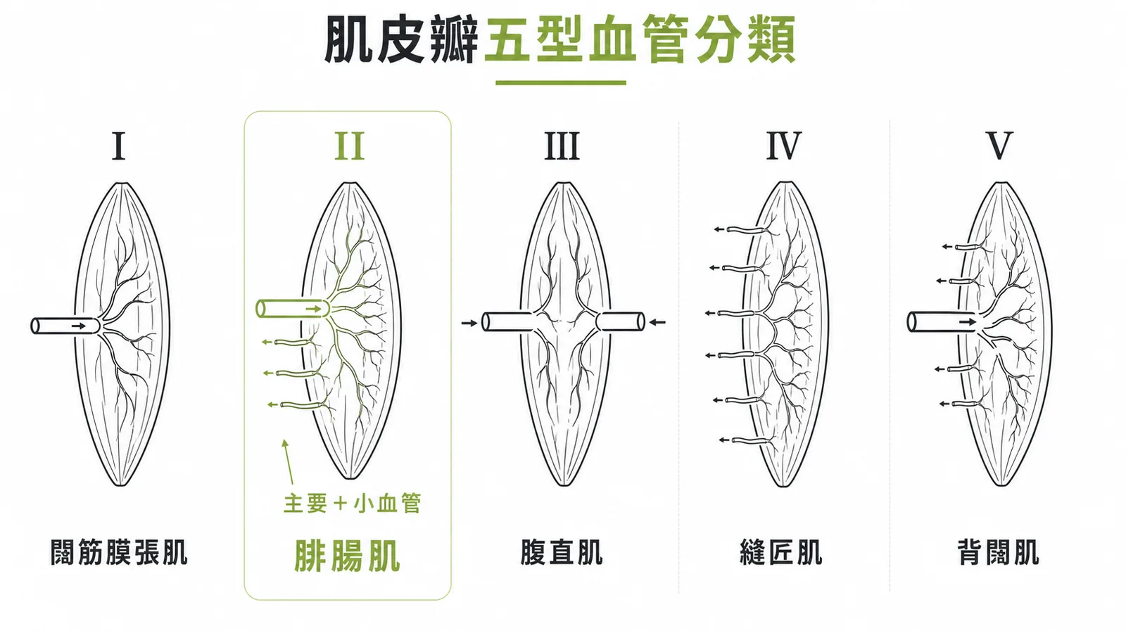 Mathes-Nahai肌皮瓣五型血管分類:腓腸肌屬Type II