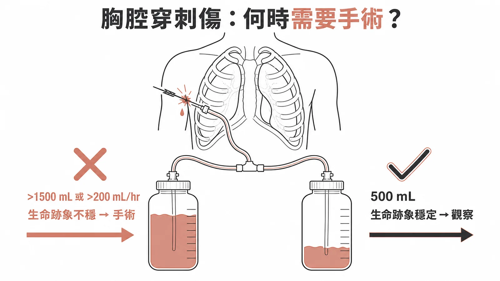 胸腔穿刺傷手術適應症:出血量與生命跡象決策示意圖
